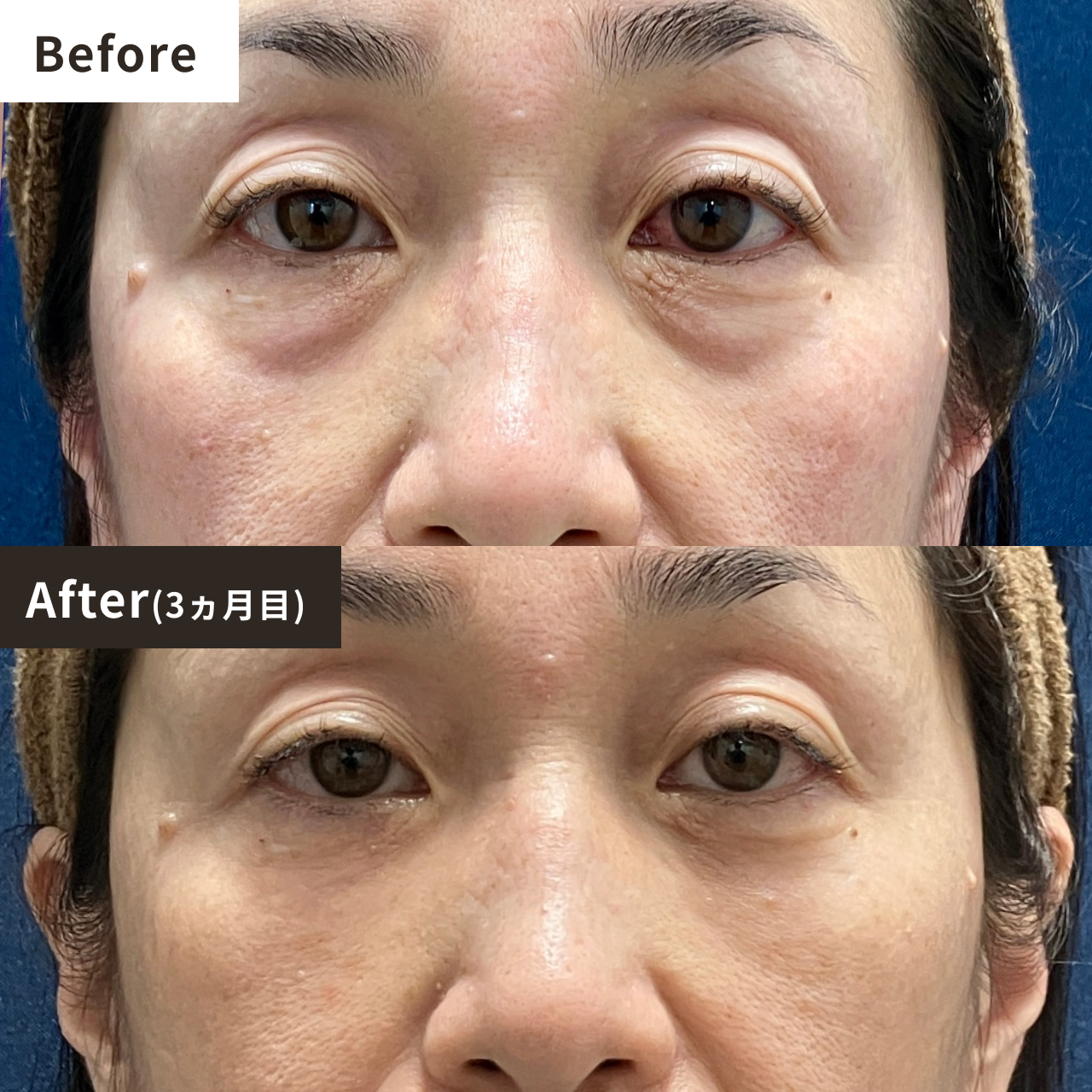 Before After