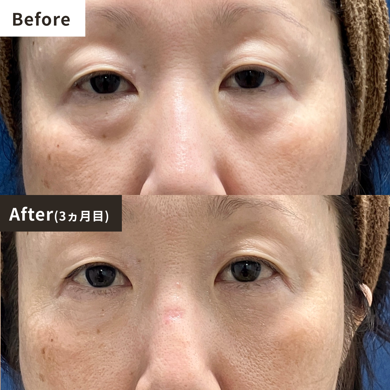 Before After