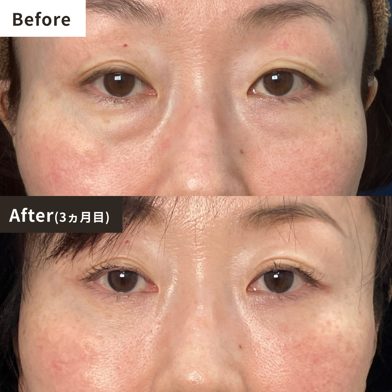 Before After