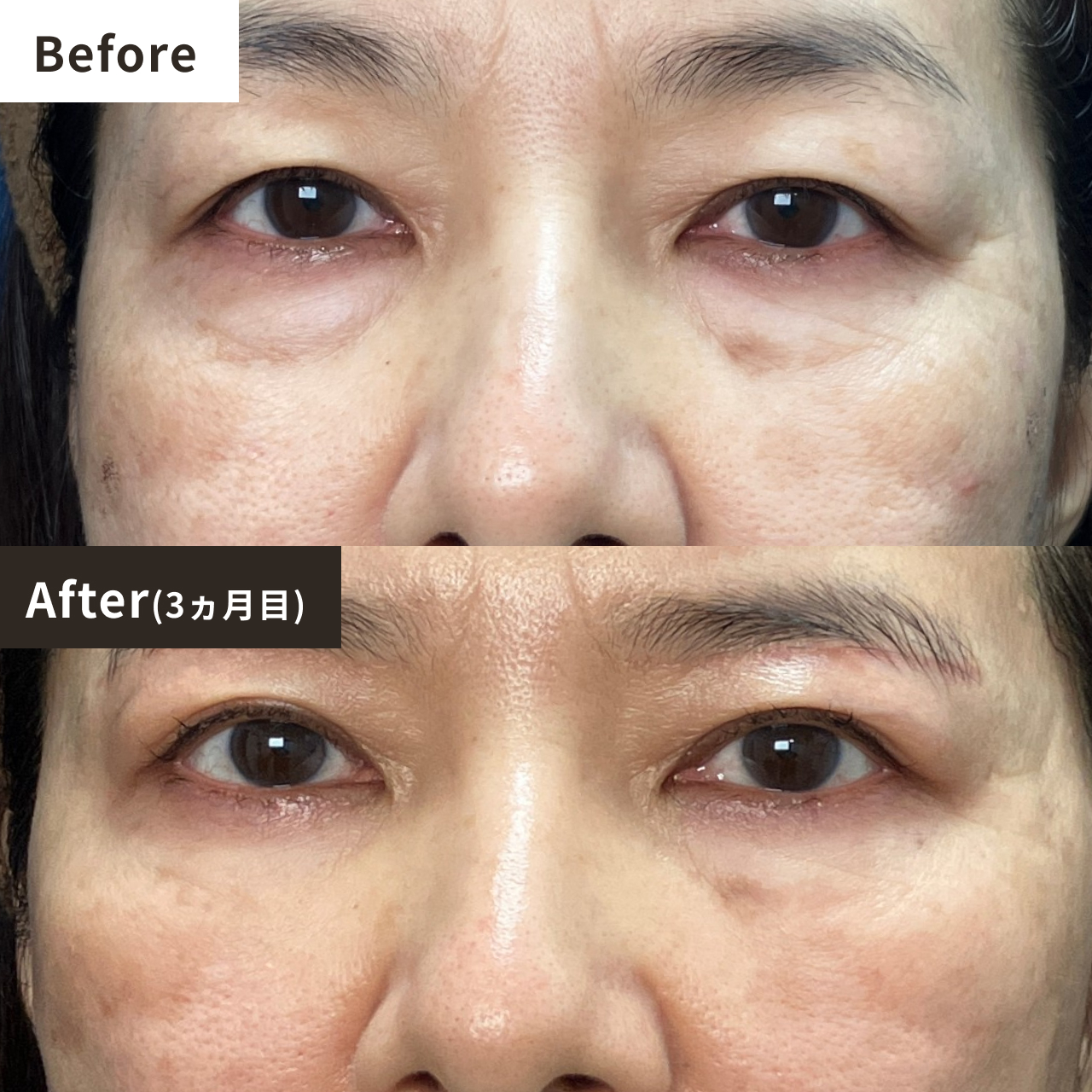 Before After