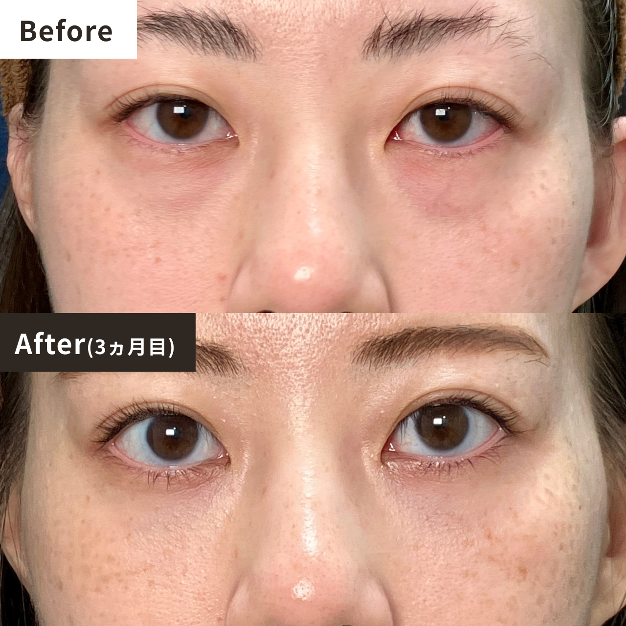 Before After