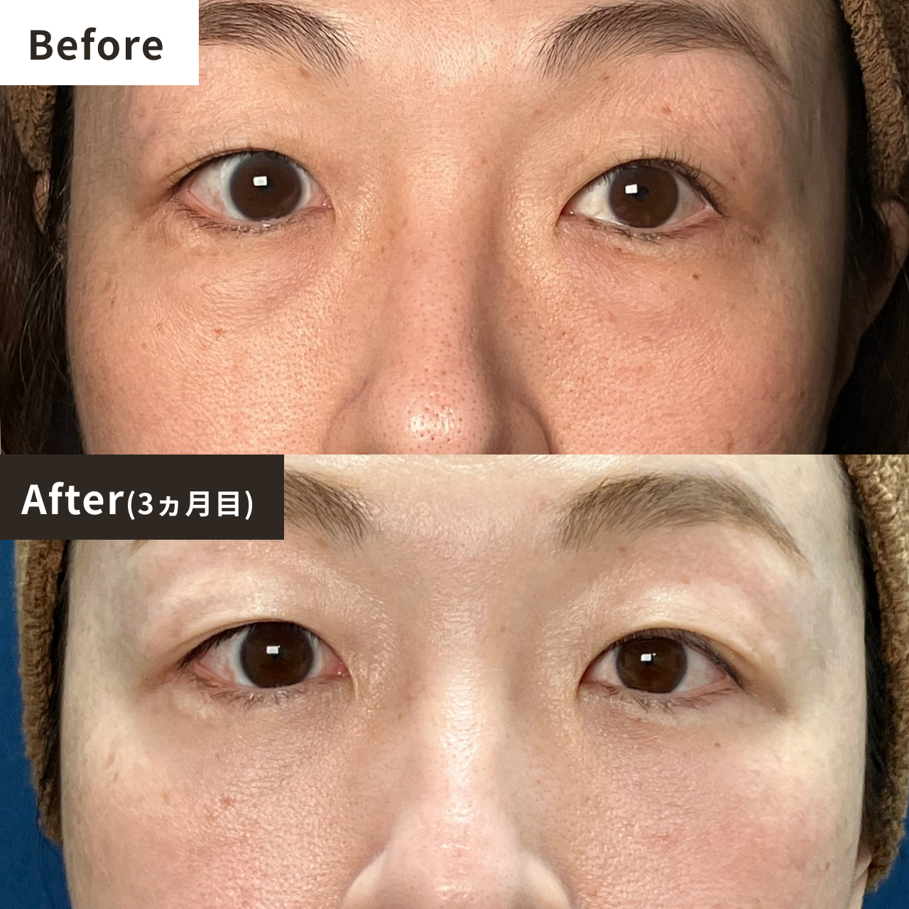 Before After