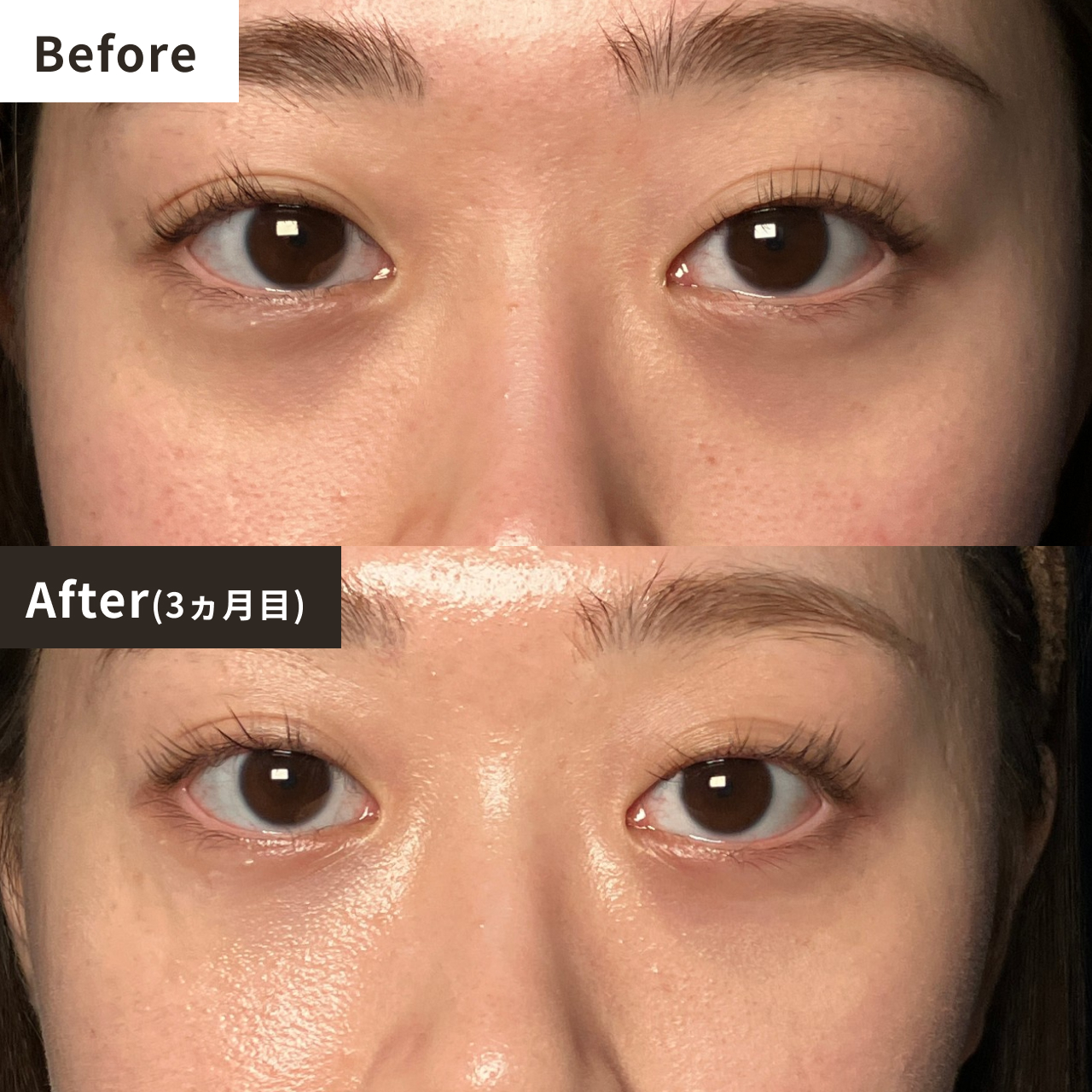 Before After