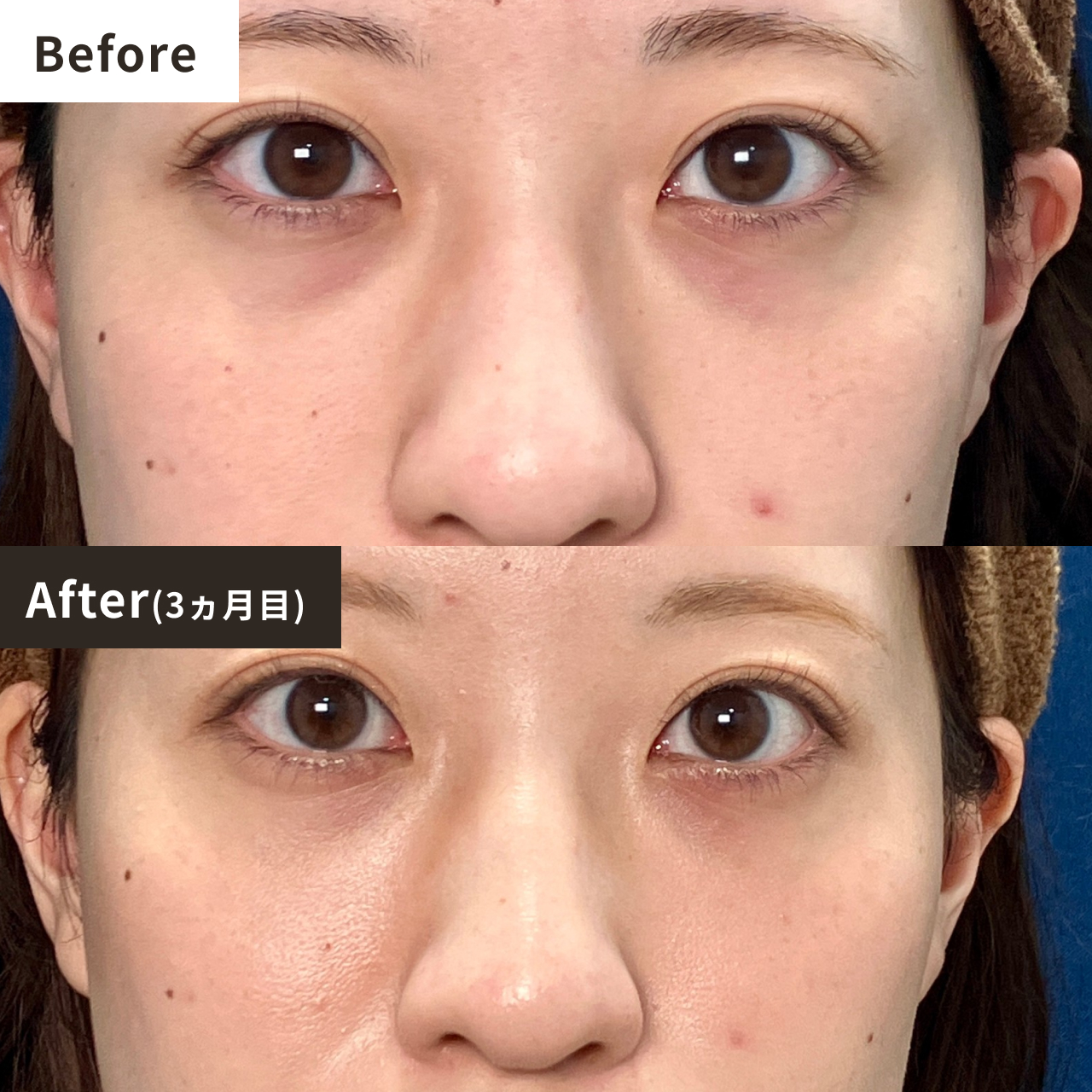 Before After