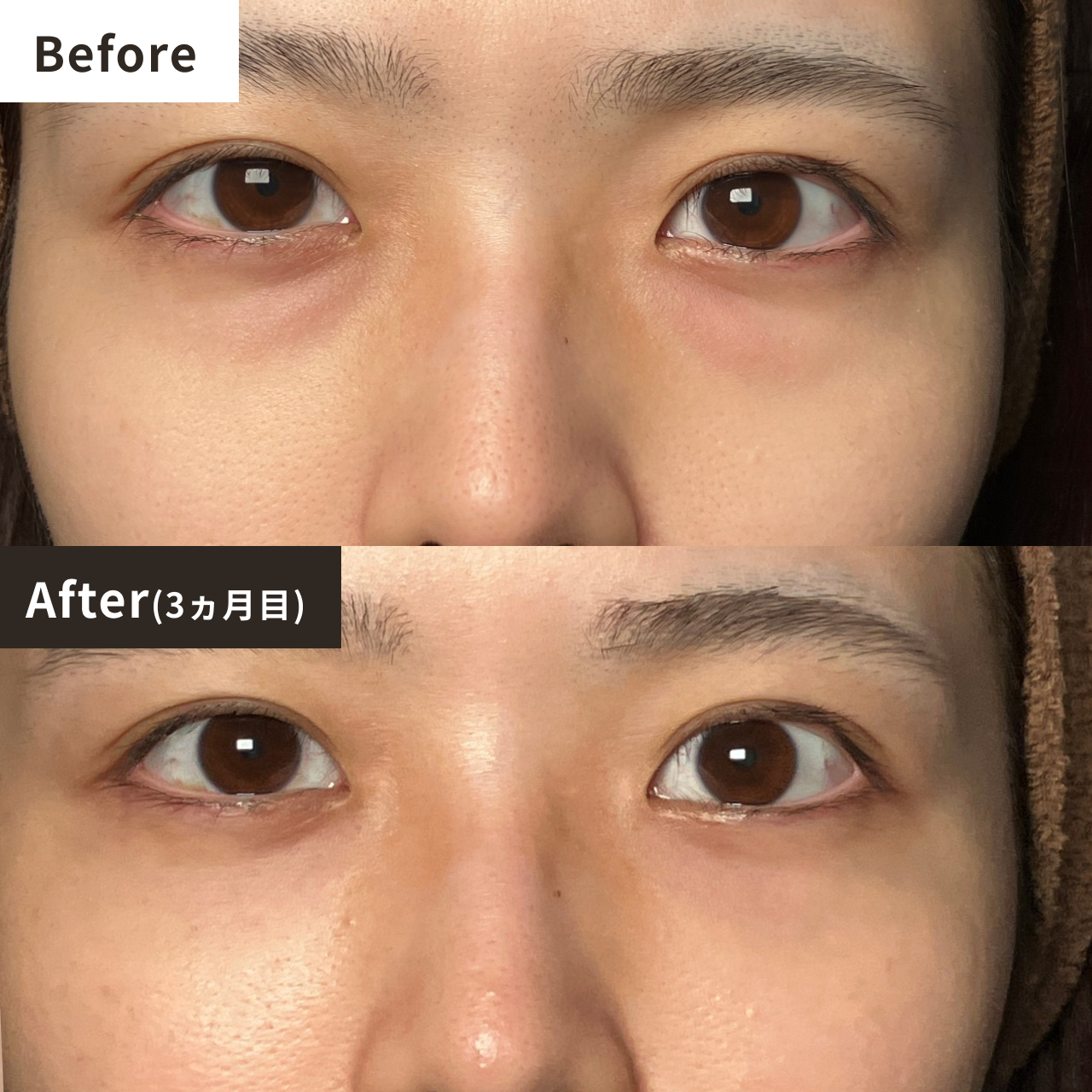 Before After