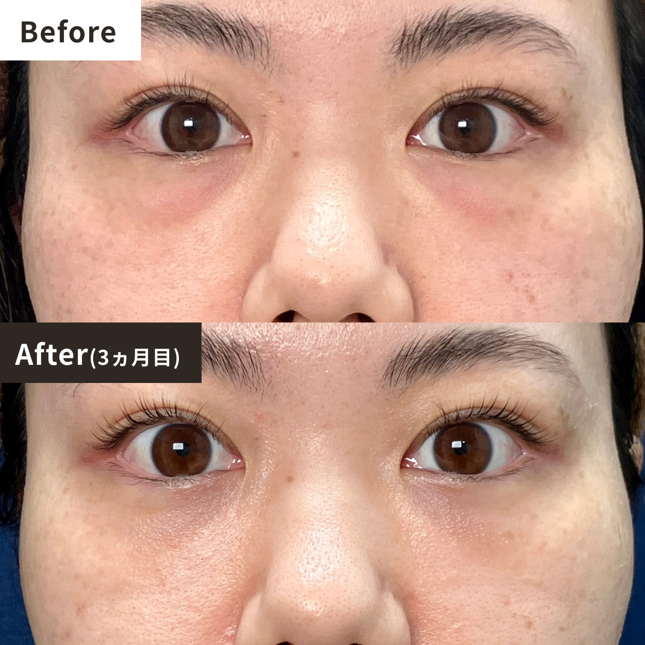 Before After（3ヶ月目）