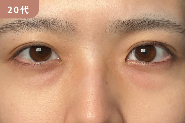 20代