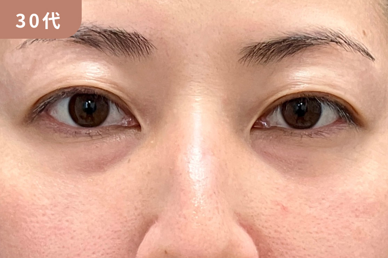 30代