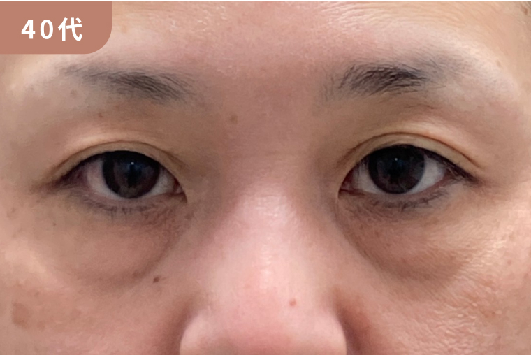40代