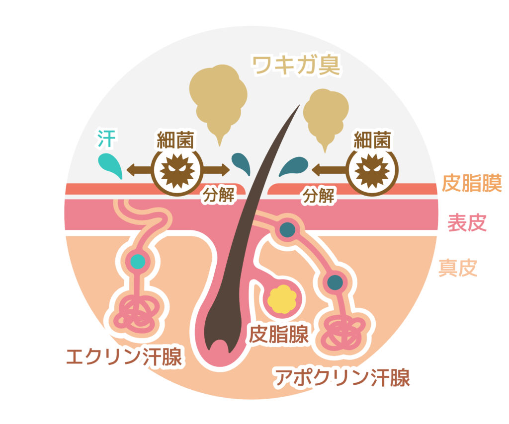 脇汗とワキガの発生メカニズムをまとめた図