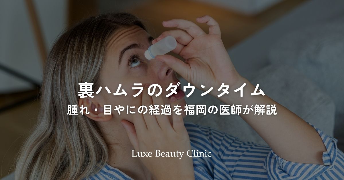 裏ハムラのダウンタイム